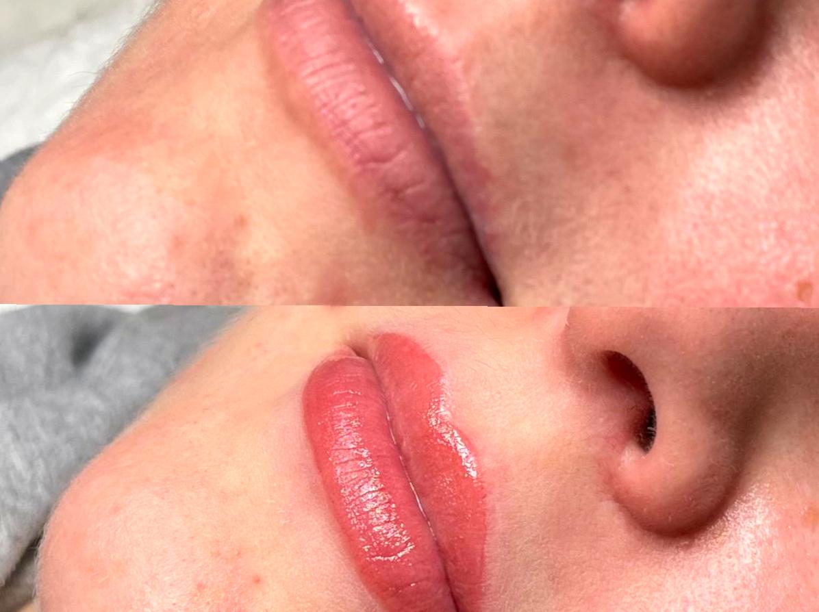 A Comprehensive Guide to Lip Neutralization Tattoo Techniques